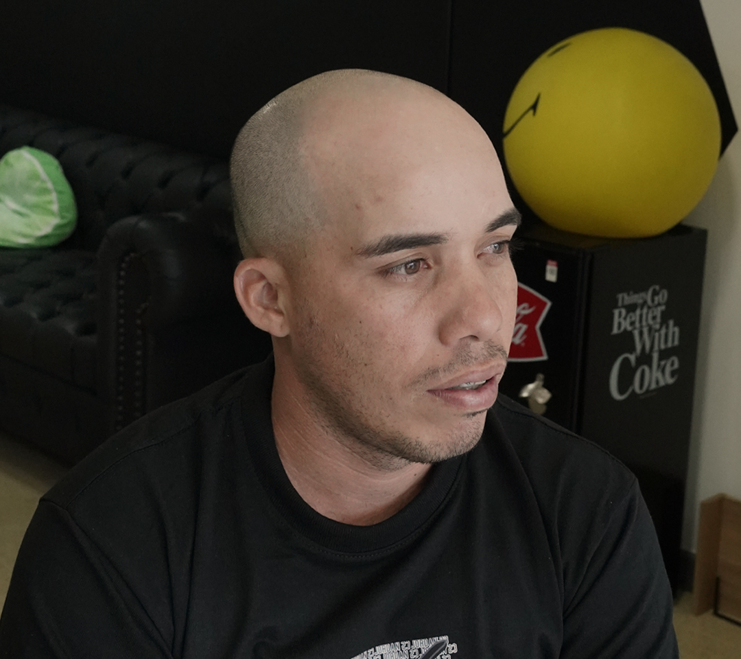 Micro-realismo capilar, no mas calvicie