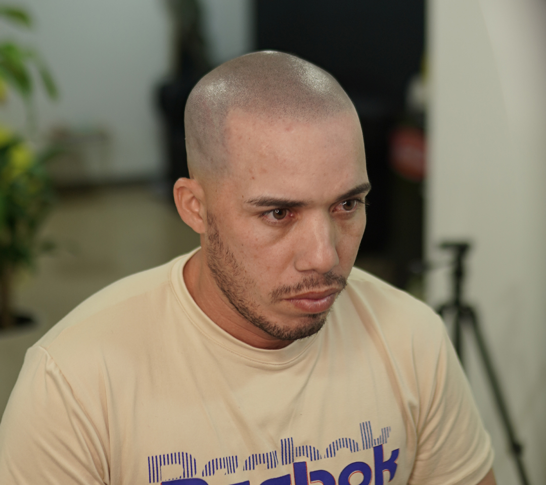 Micropigmentacion capilar 100% natural