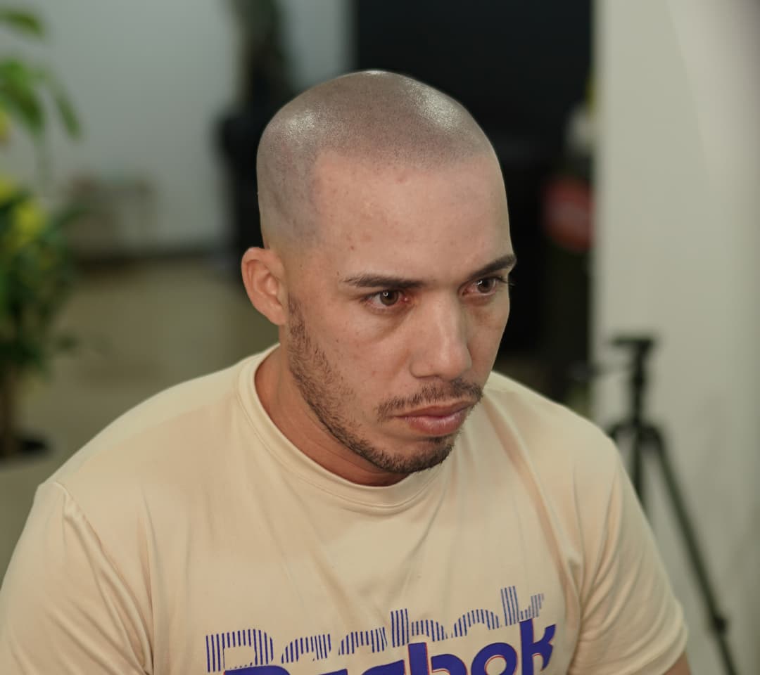 After image