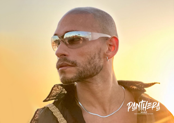 Micropigmentación capilar, la solución contra la alopecia en medellin